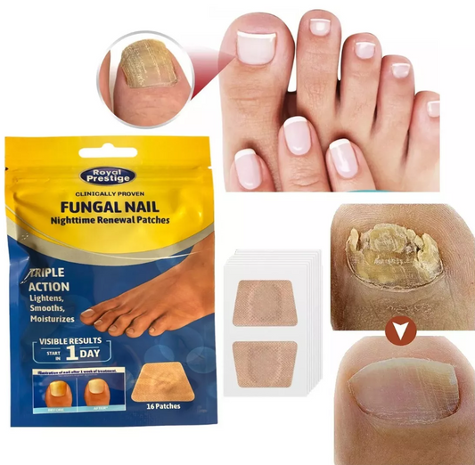 Parches Antihongos para Uñas – PackX2 Cajas