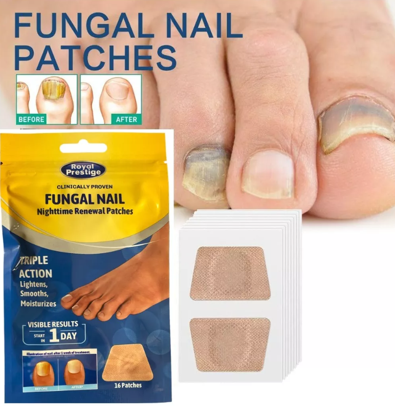 Parches Antihongos para Uñas – PackX3 Cajas